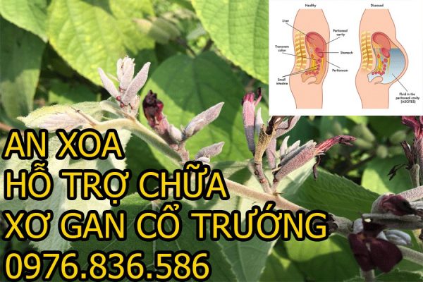 Cây an xoa hỗ trợ điều trị xơ gan cổ trướng 1