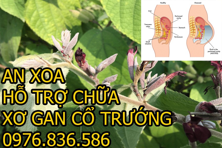 Cây an xoa hỗ trợ điều trị xơ gan cổ trướng 1