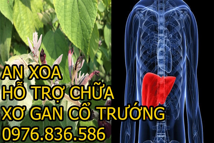 Cây an xoa hỗ trợ điều trị xơ gan cổ trướng 2