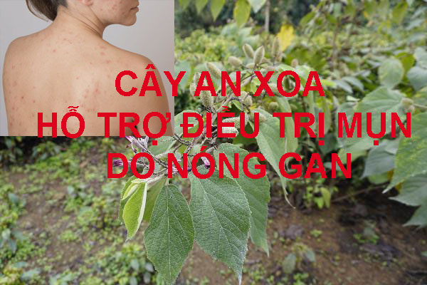 Cây an xoa hỗ trợ điều trị mụn